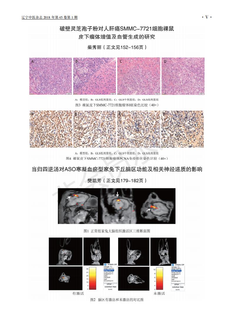243 破壁leyu乐鱼中国官方网站中国农业有限公司孢子粉对人肝癌SMMC-7721细胞裸鼠皮下瘤体增殖及血管生成的研究_04.jpg